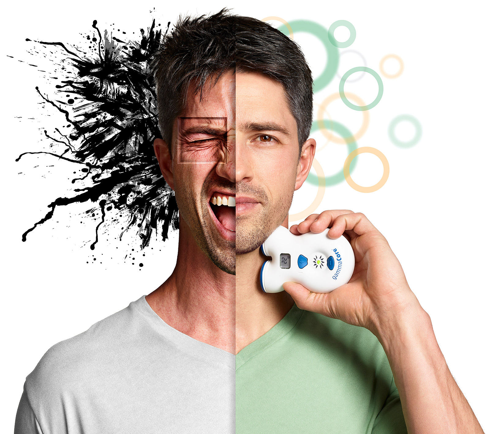 What it feels like before and after treating headache using gammaCore (nVNS) Image of male episodic cluster headache patient with gammaCore